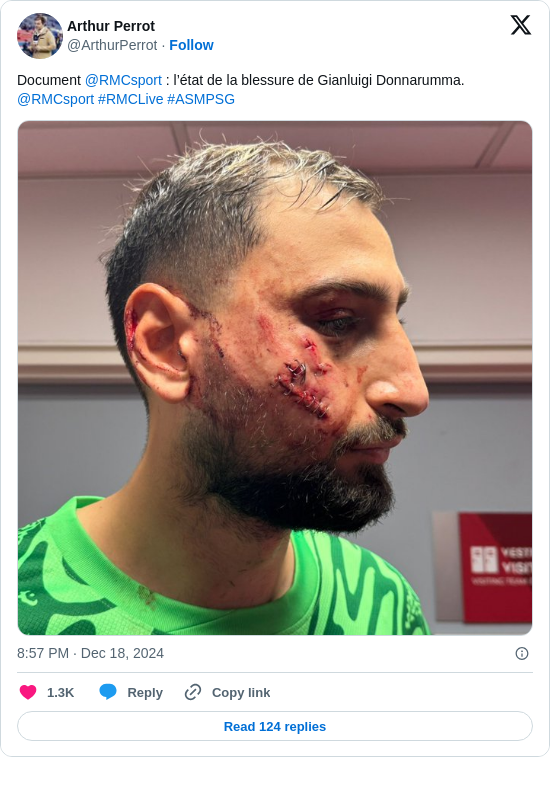 Arthur Perrot: Document @RMCsport : l’état de la blessure de Gianluigi Donnarumma.
@RMCsport #RMCLive #ASMPSG https://t.co/i3GR7McGgw