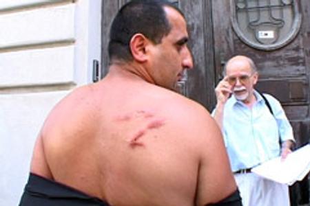 Peter Sendrei displays his injuries.