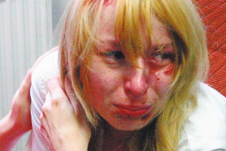 Hedviga Malinová, after the alleged attack.