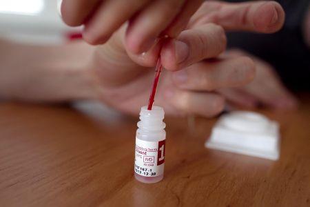 Delayed tests threaten treatment of HIV-positive people