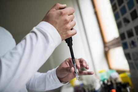 Measles are confirmed with lab tests, illustrative stock photo