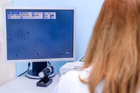 To be fertile, a man has to have 15 million sperms per milligram of ejaculate, of which 4 million must be healthy.