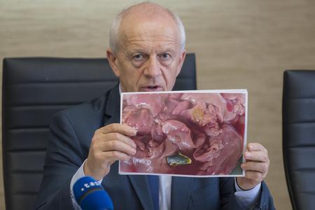 State Veterinary and Food Administration head Jozef Bíreš shows a photo of Brazilian chicken livers contaminated by gall. 