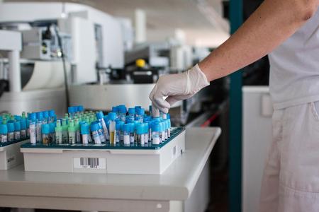 Košice hospital patient died after the wrong transfusion
