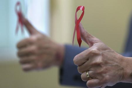 Slovakia recorded 102 new HIV cases in 2018. 