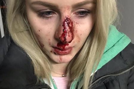 Man who bashed ex-girlfriend’s head fined with €1,500
