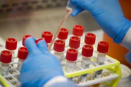 Matovič criticises COVID-19 tests. Head of the material reserves will be dismissed