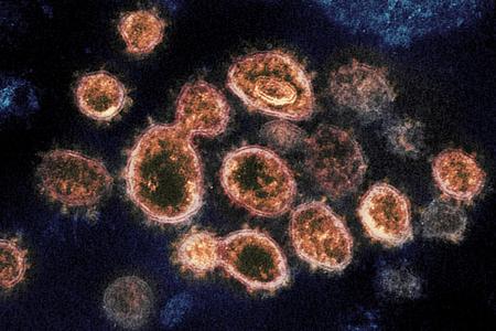 This 2020 electron microscopic image provided by the National Institute of Allergy and Infectious Diseases - Rocky Mountain Laboratories shows SARS-CoV-2 virus particles, which cause COVID-19, isolated from a patient in the U.S.