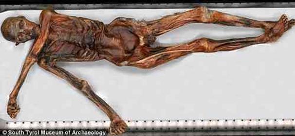 Ötzi - kompletná múmia