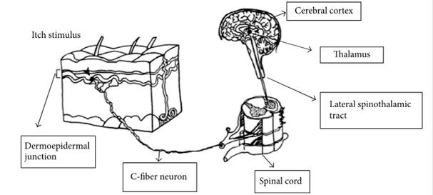 Obr. 2: Cesta impulzu, vyvolávajúceho svrbenie, od periférie (dermoepidermal junction), prostredníctvom nervových vlákien (C-fiber neuron), cez útvary miechy (spinal cord) do laminárnych jadier medzimozgu (thalamus), s prenosom (prepojením) do štruktúr mo