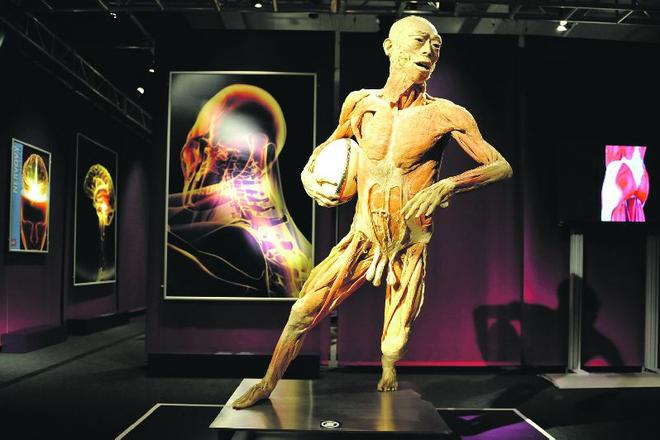 The exhibited bodies have prompted criticism.