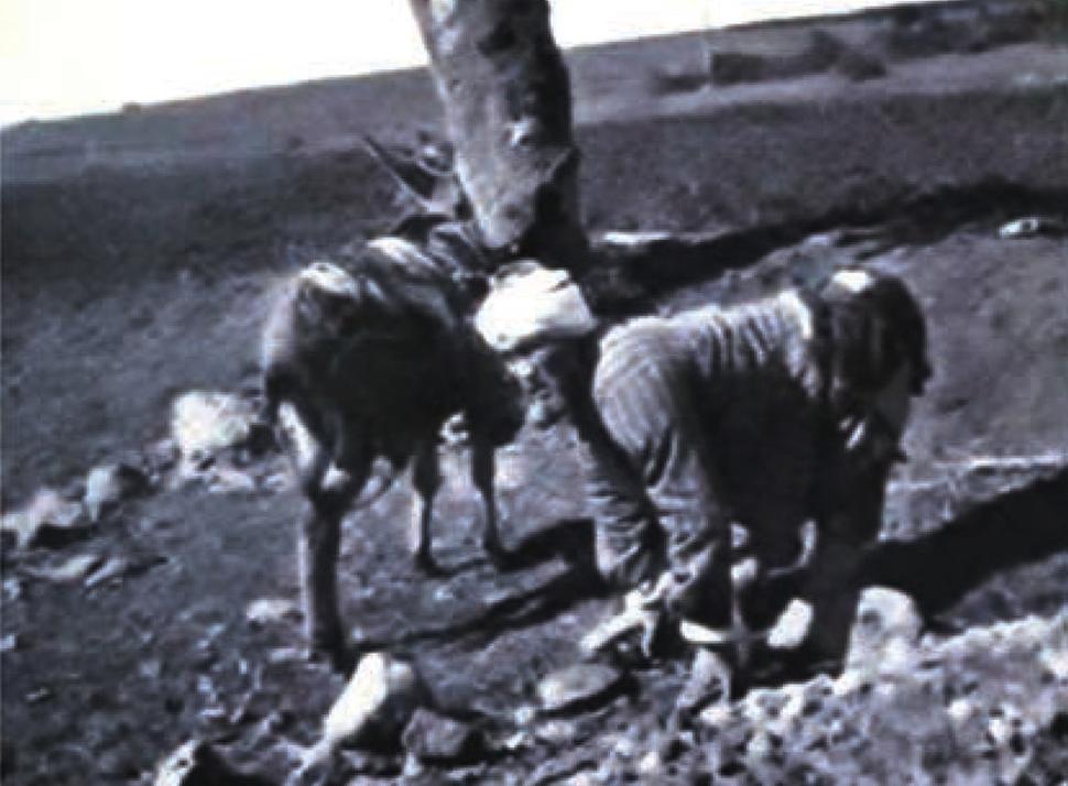 Prvá fotografia človeka s Uner Tanovým syndrómom z roku 1917.