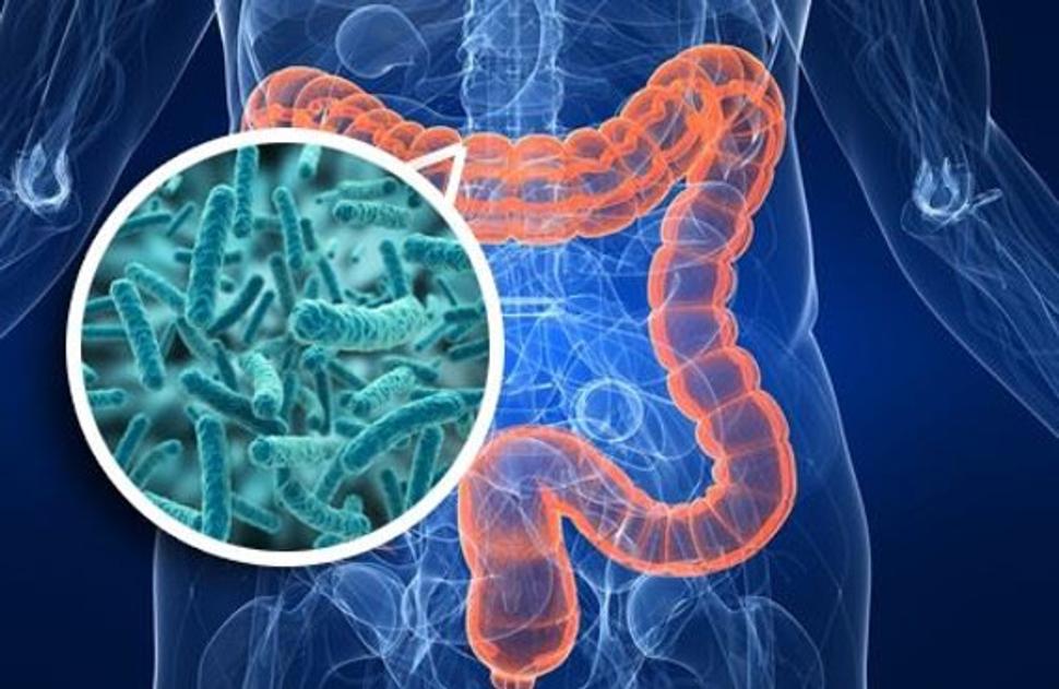 Obr. 5: Bacillus subtilis, jedna z najvýkonnejších probiotických baktérií, foto zdroj ttps://wellness-studio.co.uk/bacillus-subtilis-and-bacillus-licheniformis-bacteria-in-the-human-intestine/