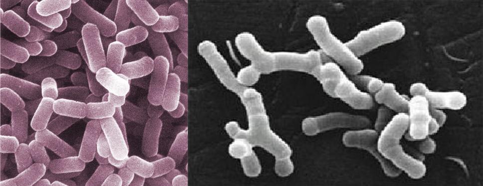 Obr. 1: LAKTOBACILY, BIFIDOBAKTÉRIE, foto zdroj: https://www.differencebetween.com/difference-between-lactobacillus-and-vs-bifidobacterium/
