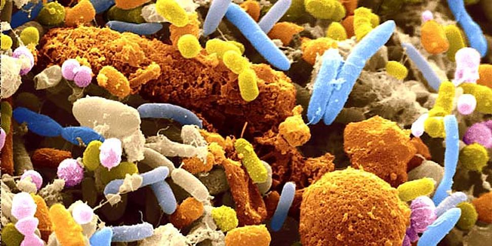 Obr. 4: Črevný mikrobióm, ilustračné foto, zdroj: https://jewishbusinessnews.com/2014/11/11/twin-study-finds-body- weight-influenced-by-microbes-in-the-gut/microbes-in-the-gut/