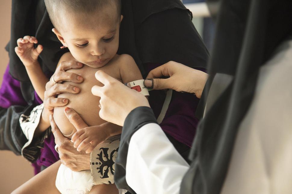 Deti v Jemene platia za vojnu priveľkú cenu. Najmä novorodenci, ktorí sú vždy náchylní na komplikácie pri narodení vrátane chorôb ako zápal pľúc, hnačky atď.