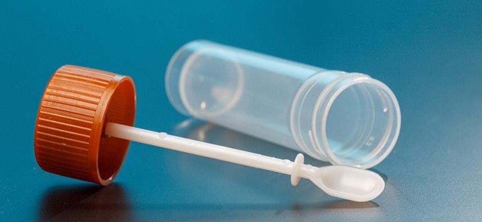 Obr. 3: Dnešná diagnostika syndrómu priechodnosti čreva sa opiera o komplexné vyšetrenie mikrobiómu zo stolice. Ilustračné foto zbernej nádobky, zdroj: https://mamaaja.sk/chore-dieta/vysetrenie/laboratoria-krv-moc-stolica/vysetrenie-stolice