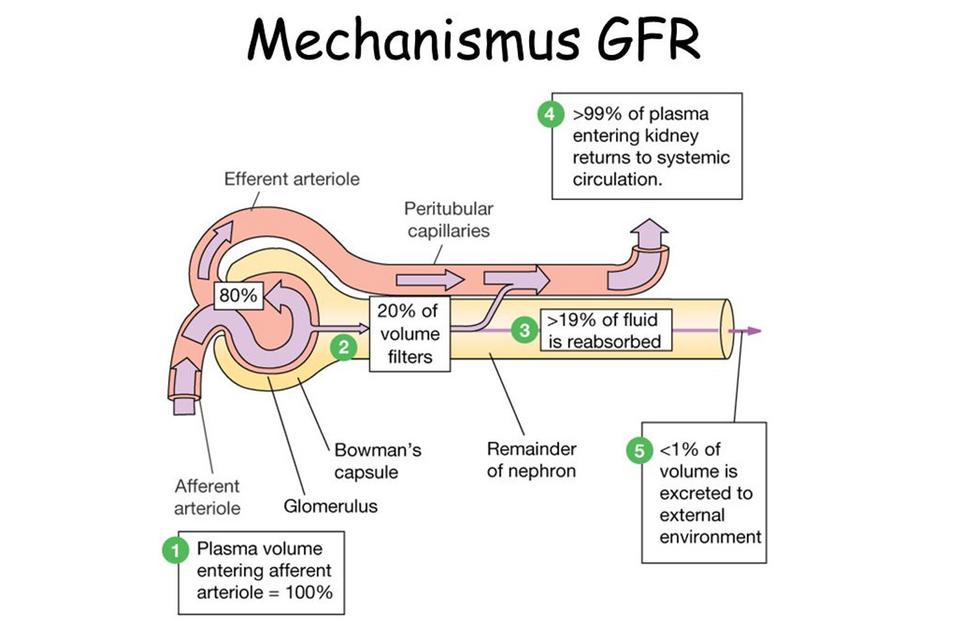 Obr. 3: Znázornenie princípu fungovania glomerulárnej filtrácie (GFR) a miest hlavných rizík jej ohrozenia. Zdroj: https://nefrolka.estranky.sk/clanky/stupajuca-hladina-kreatininu.html