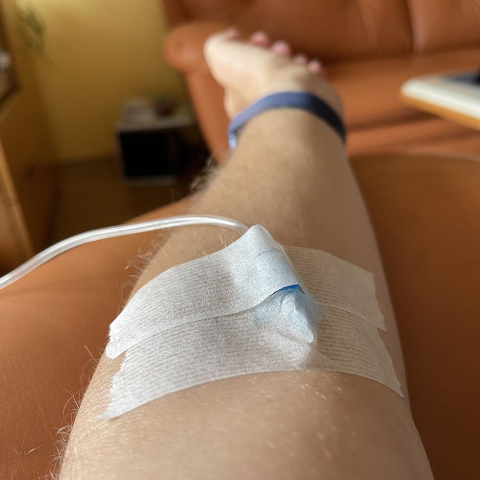 infúzia doma - mega dávka vitamínu C