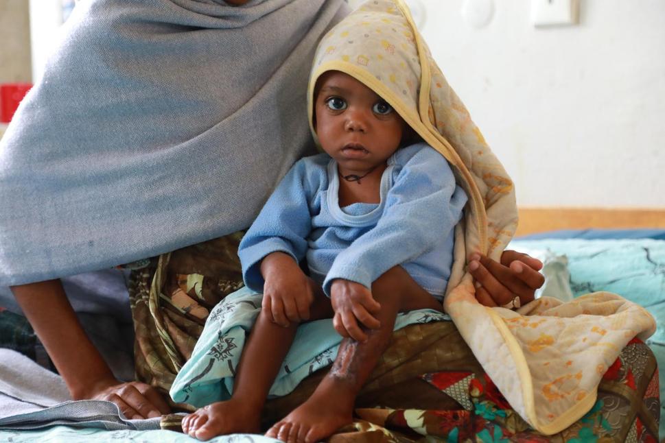 Vážne podvyživené dieťatko v náručí svojej mamy vo výživovom centre podporovanom UNICEFom v Tigraji, Etiópia.