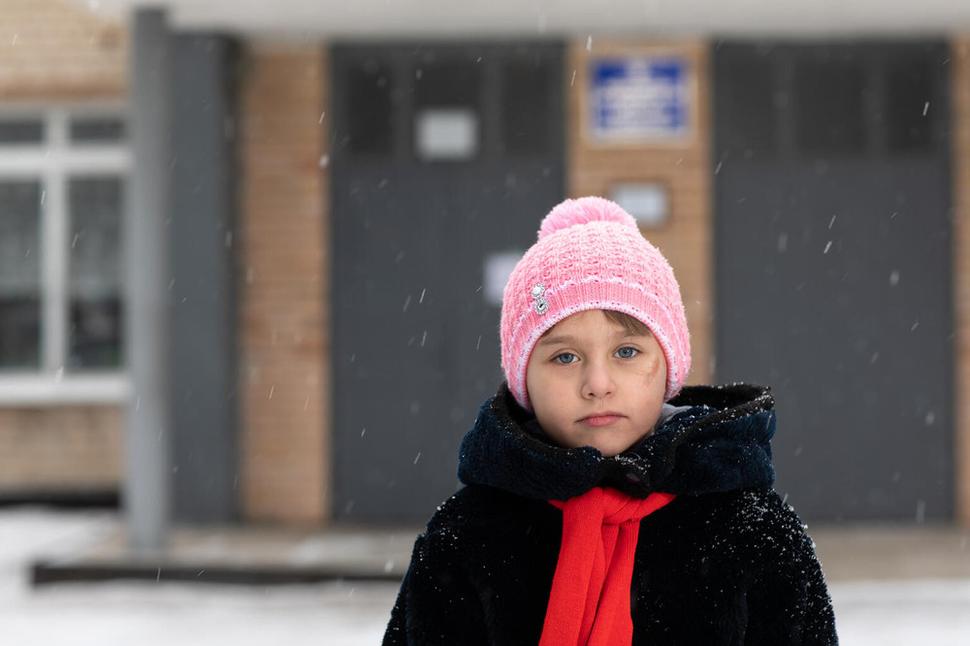 Polina, 7, z východnej Ukrajiny nesie jazvy zo zranení, ktoré utrpela pri výbuchu šrapnelu pred domom jej rodičov keď mala jeden rok. Jej stará mama pri výbuchu zahynula a rodičia boli vážne zranení. Rodina sa ocitla na hranici chudoby a UNICEF im pomáha prečkať najťažšie obdobie.