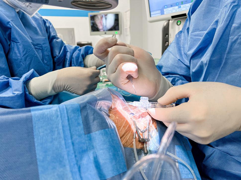 Operácia sivého zákalu na klinike UVEA.