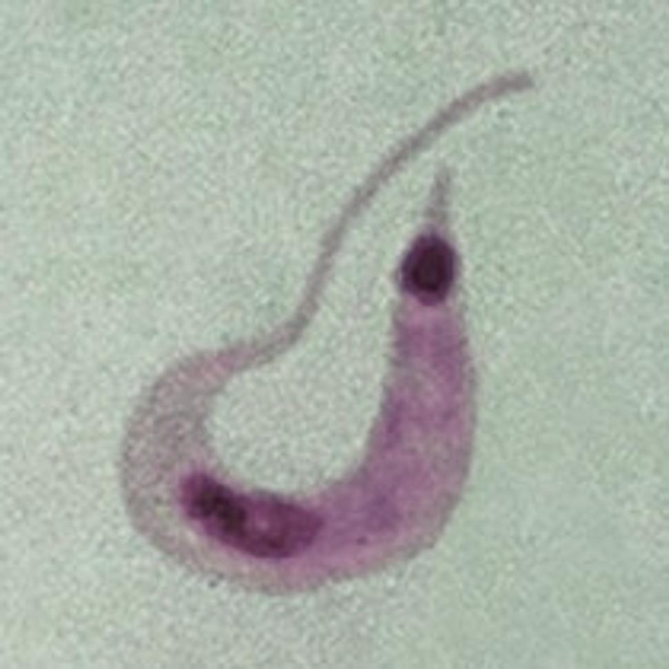 Trypanosoma cruzi