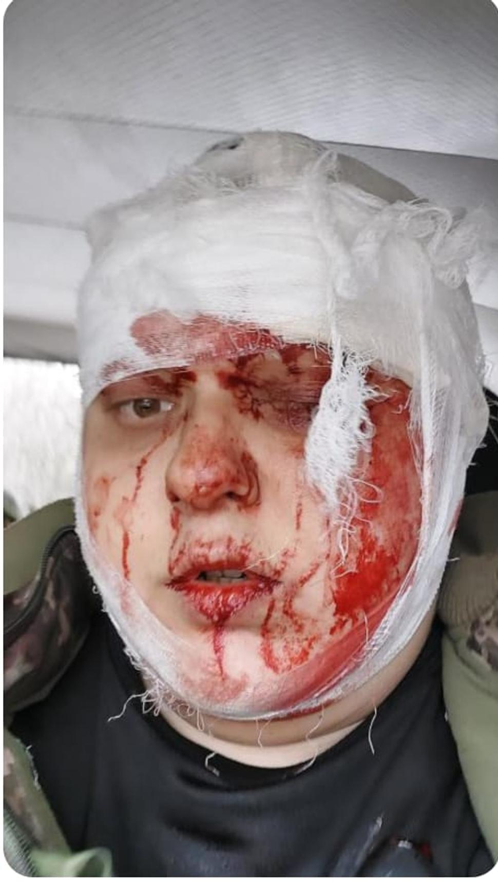 Foto Slavik po zranení začiatkom roka. Celkom dobre sa z toho vystrábil, napriek hrozivým ranám.
