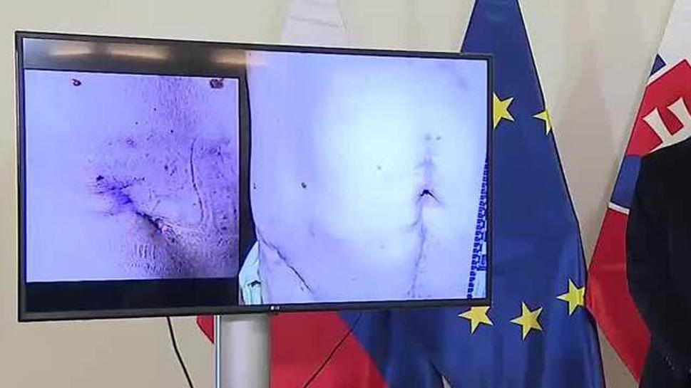 https://spravy.pravda.sk/domace/clanok/751777-kalinak-a-gaspar-sa-obavaju-dalsieho-incidentu-na-vystrahu-ukazali-ficovo-brucho/?utm_source=pravda&utm_medium=hp-box&utm_campaign=shp_3clanok_box