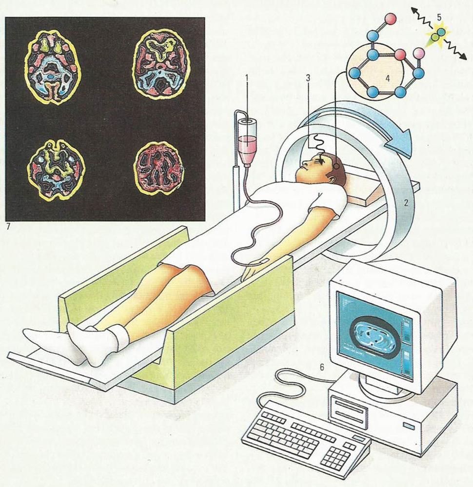 PET - Pozitrónová emisná tomografia 