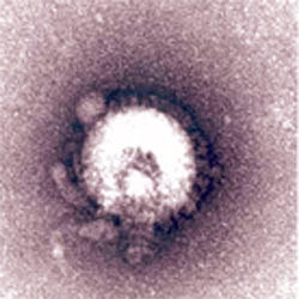 To je on - vírus H5N1