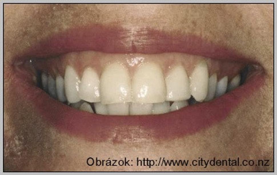 Obrázok blogu