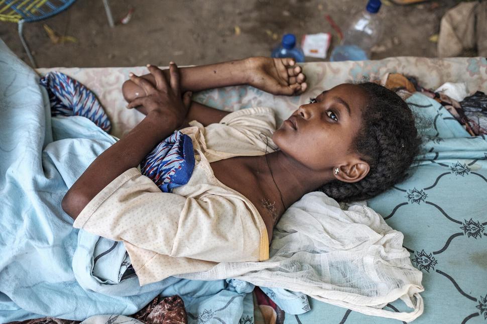 Mladé dievča sa zotavuje po útoku vo svojom dome v meste Humer, v Etiópii. Od novembra 2020 v oblasti Tigray prebieha ozbrojený konflikt medzi povstalcami TPLF a armádou. Tisícky ľudí prišli o život, desaťtisíce utiekli do Sudánu.