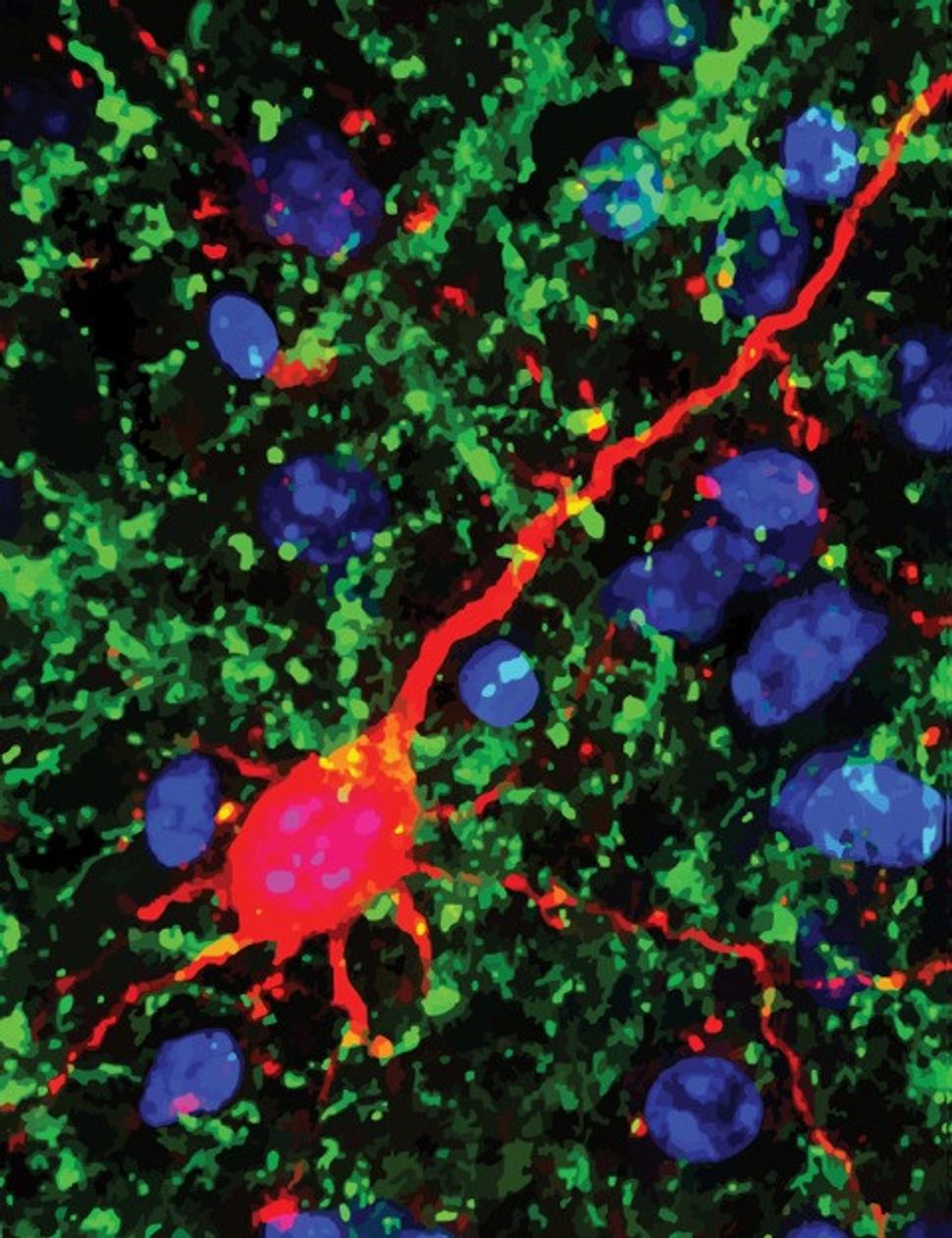 Neuróny