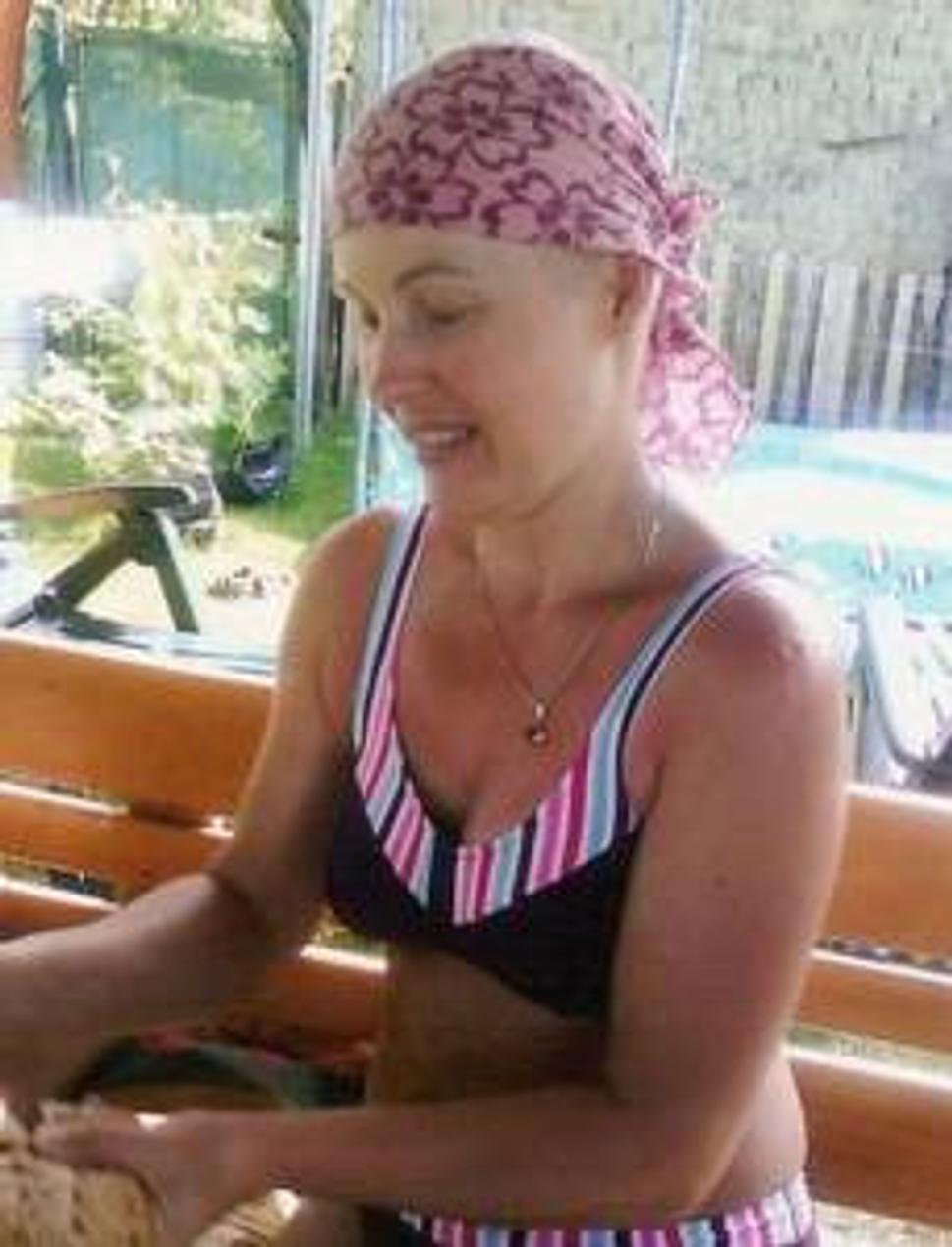 Mám za sebou 6 chemoterapií, už po prvej mi vypadali všetky vlasy, obočie aj mihalnice.