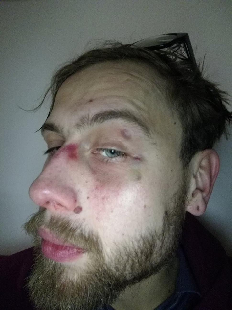 Andrej po sparingoch