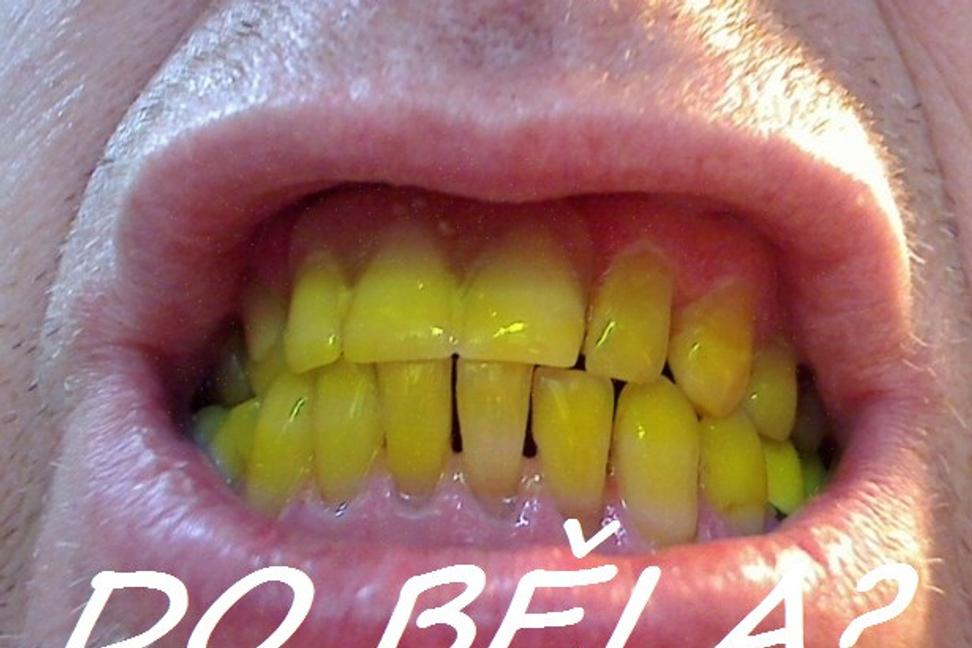 Zuby do běla