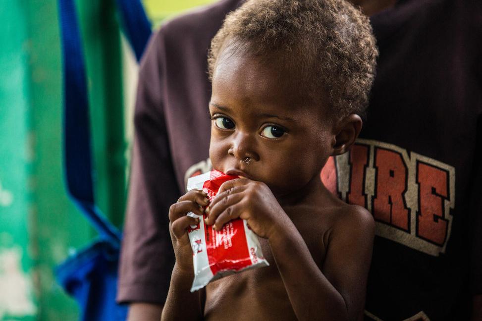 3 milióny detí zomrie ročne na podvýživu, 3 € to môžu zmeniť