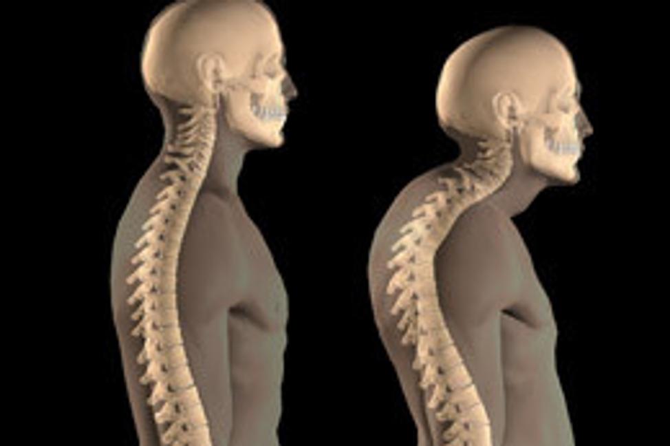 Bolesti chrbta často vyriešite správnym tréningom