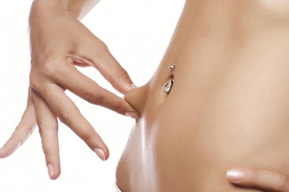 Liposukcia - zaručený spôsob ako natrvalo schudnúť?
